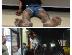 Pelaku Jambret Kota Siantar Babak Belur ditangan Warga